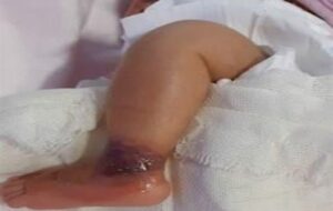 ماجرای یک نوزاد در بیمارستان امام سجاد(ع) شهر یاسوج