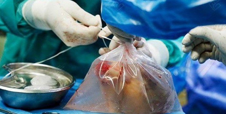 ادامه ایثارگری یک ایثارگر/ اهدا عضو آزاده گچسارانی به بیماران نیازمند ادامه ایثارگری یک ایثارگر/ اهدا عضو آزاده گچسارانی به بیماران نیازمند